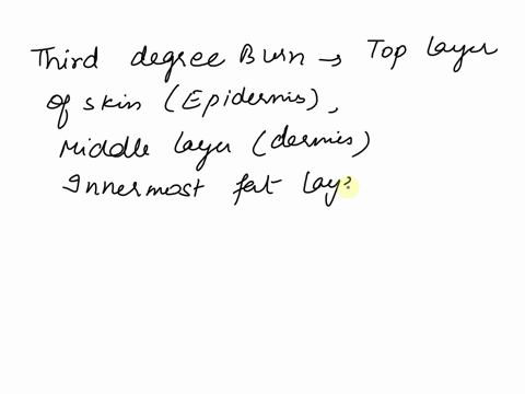 why-is-a-third-degree-burn-immediately-life-threatening-loss-of-sensory-neurons-catastrophic-fluid-loss-and-electrolyte-imbalance-risk-of-infection-difficulty-breathing-due-to-unbearable-pai-10932