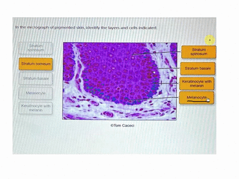 in-the-micrograph-of-pigmented-skinidentify-the-layers-and-cells-indicated-stratum-spinosun-stratum-spinosum-stratum-comeum-stratum-basale-stratum-basale-keratinocyte-with-melanin-melanocyte-91406