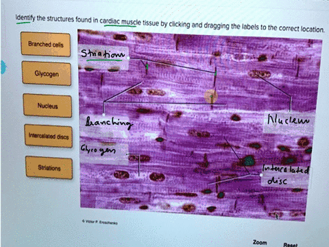 saved-help-saveexi-identify-the-structures-found-in-cardiac-muscle-tissue-by-clicking-and-dragging-the-labels-to-the-correct-location-branched-cells-glycogen-nucleus-intercalated-discs-stria-43465