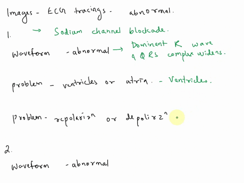 for-each-of-the-following-ecg-tracingsdetermine-the-following-1-1a-what-waveform-is-abnormal-1b-is-the-problem-with-the-ventricles-or-atria-1c-is-it-a-depolarization-or-repolarization-proble-04548