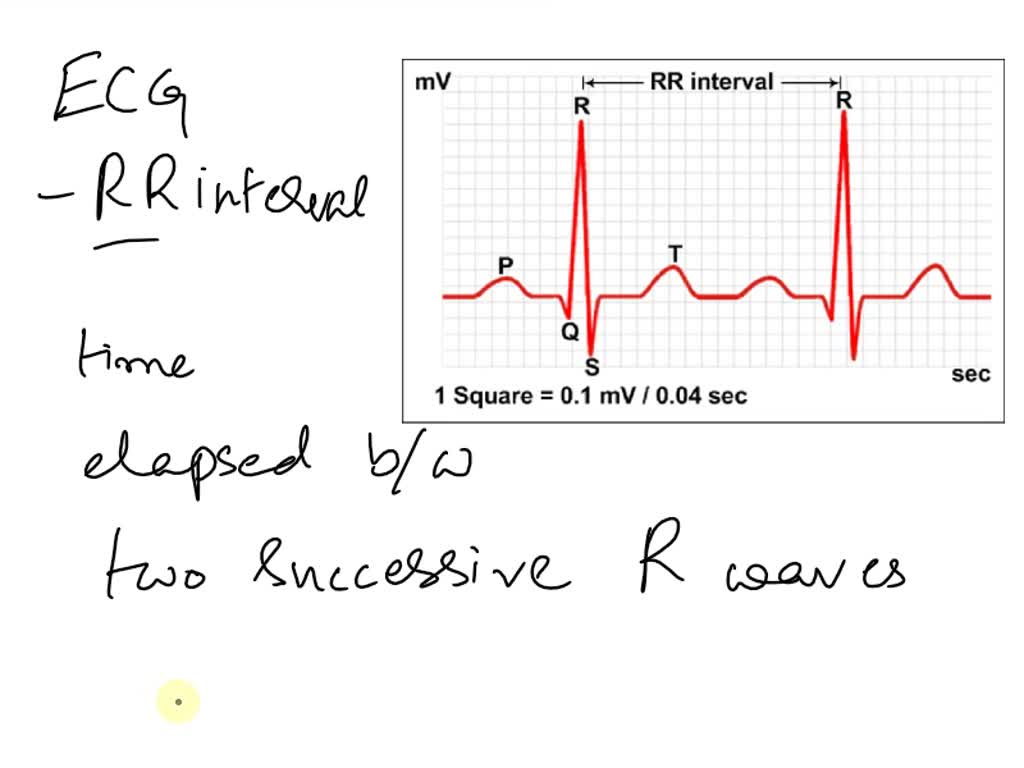 SOLVED On an EKG strip other normal amount of boxes for a QRS interval