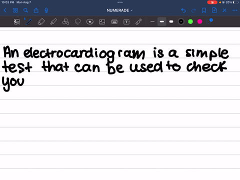 describe-an-electrocardiogram-and-a-procedure-in-which-it-might-be-used
