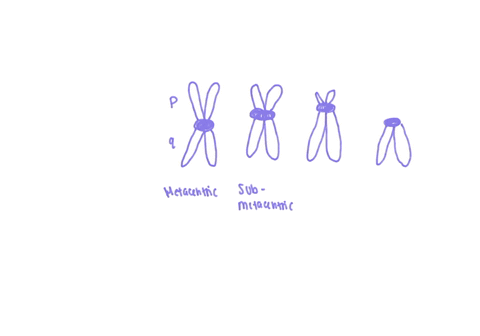 classify-the-chromosome-based-on-its-centromere-remember-that-chromosomes-are-classified-by-terms-ending-in-centric-10512