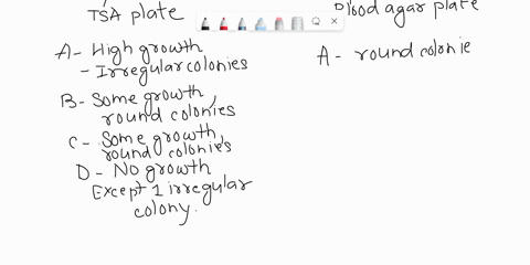 examine-your-plate-and-the-blood-agar-plate-from-your-lab-table-draw-what-you-see-on-both-plates_-tsa-plate-blood-agar-plate-2-define-the-term-bacterial-colony-and-explain-how-it-relates-to-60403