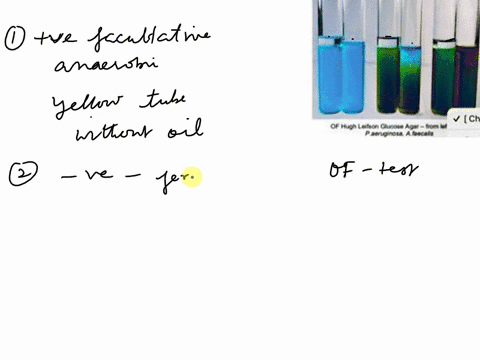 can-someone-help-me-with-this-question-please-thank-you-choose-of-hugh-leifon-gucoe-agar-from-prginosa-afca-green-tube-with-oil-and-sourcebiolif-blue-tube-without-oil-methyl-red-which-test-s-31868