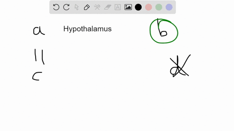 the-organ-that-is-connected-to-the-hypothalamus-by-neurons-the-adenohypophysis_-posterior-pituitary-anterior-pituitary-thyroid-92397