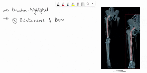 which-structure-is-highlighted-multiple-choice-obturator-nerve-sciatic-nerve-and-branches-tibial-nerve-femoral-nerve-53731