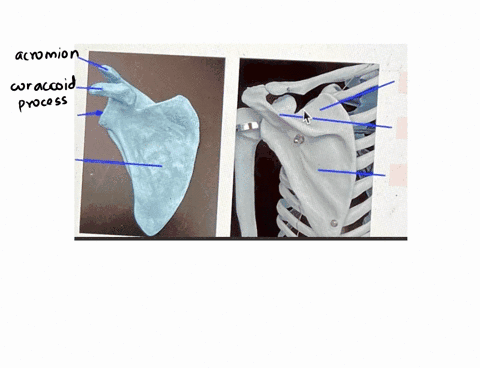 label-each-part-mianc-comm-collec-bio-241-anatomy-physiology-llab-bone-bone-region-bone-marking-06693