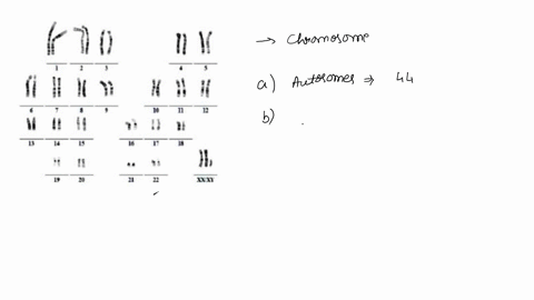 patient-b-is-a-28-year-old-male-who-is-trying-to-identify-cause-for-his-infertility-chromosomes-were-obtained-from-nucleated-cells-in-the-patients-blood-ka-please-answer-the-following-questi-65247