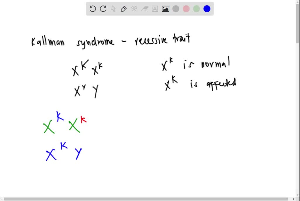 SOLVED: For the recessive X-linked trait below (Kallmann syndrome ...