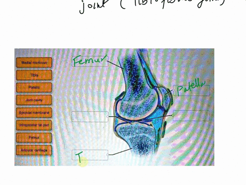 correctly-label-the-following-anatomical-features-of-the-tibiofemoral-joint-medialmeniscus-tibla-patella-joint-cavity-synovialmembrane-infrapatellar-tat-pad-femur-articularcartilage-csagitta-28274