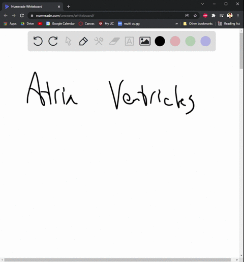 which-of-the-following-superficially-separates-the-atria-from-the-ventricles-17584