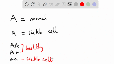 sickle-cell-anemia-is-an-autosomal-recessive-disorder-doug-has-sca-but-his-wife-is-homozygous-dominant-what-is-the-chance-that-their-child-will-have-sickle-cell-anemia