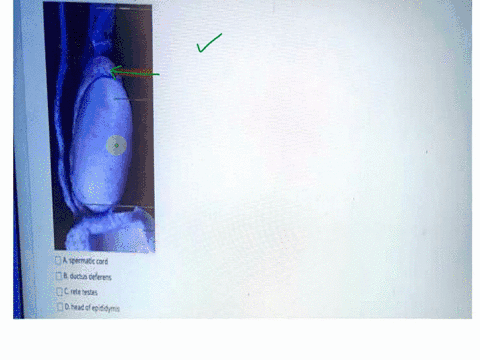 question10-identify-the-structure-indicated-by-the-arrow-aspermaticcord-suauapap-trpnpa-crete-testes-dheadof-epididymis-87215