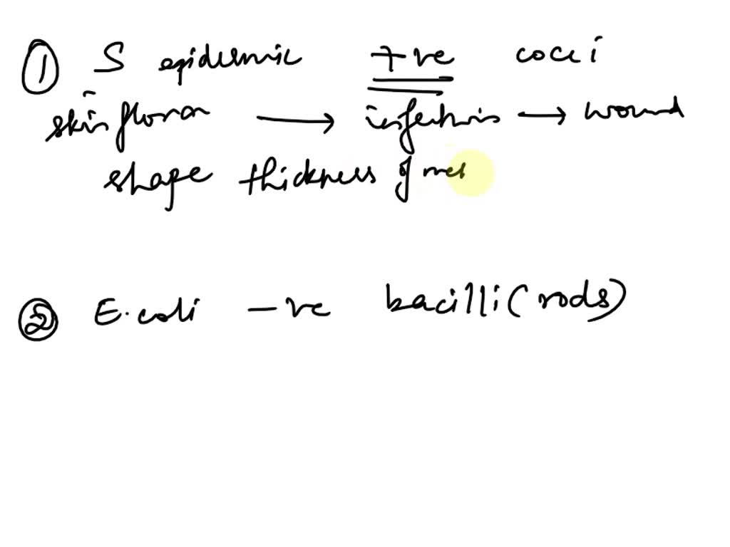 SOLVED: Unit 4, Lesson 5: Prokaryotes - CELLS alive Bacterial Cell