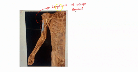 which-muscle-is-highlighted-short-head-of-biceps-brachii-brachialis-coracobrachialis-long-head-of-biceps-brachi-19618
