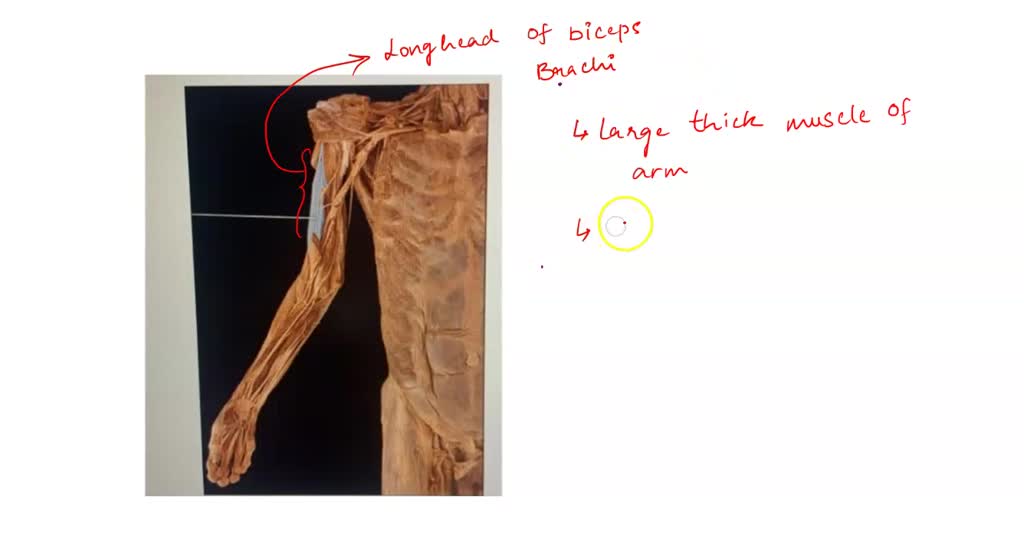 SOLVED: LT-VA16 Life-size Muscle Torso. 27-part. 3B Scientific Which ...