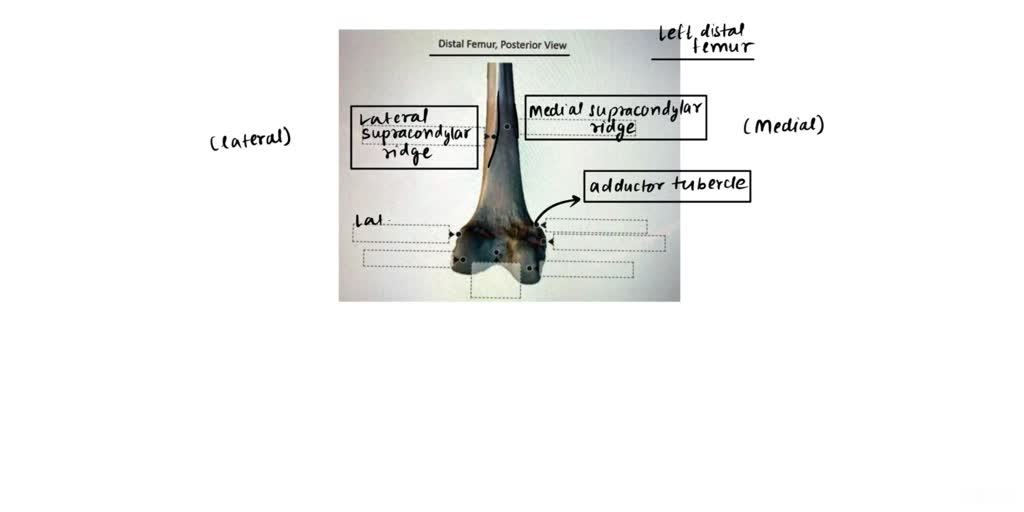 SOLVED: Medial rotation Flexion Adduction Posterior Ipsilateral ...