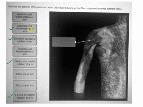 describe-the-actions-of-the-posterior-part-of-the-featured-muscle-whose-fibers-originate-from-three-different-polnts-abduction-and-medial-rolation-of-arm-extension-and-medialrotation-of-arm-81117