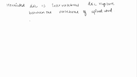 a-herniated-disc-can-occur-when-the-____-ruptures-a-intervertebral-disc-b-vertebral-column-c-lordotic-curve-f-osteomalacia-98233
