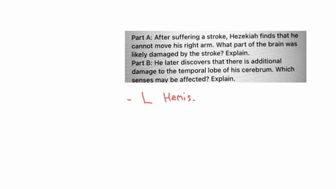 part-a-after-suffering-a-stroke-hezekiah-finds-that-he-cannot-move-his-right-arm-what-part-of-the-brain-was-likely-damaged-by-the-stroke-explain-part-b-he-later-discovers-that-there-is-addit-62036