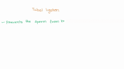a-tubal-ligation-is-a-permanent-sterilization-procedure-in-which-a-womans-fallopian-tubes-are-blocked-or-severed-which-of-the-following-explains-how-this-process-can-be-used-to-prevent-pregn-34195
