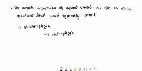 the-complete-transection-of-the-spinal-cord-at-the-c4-or-c5-vertebral-level-would-normally-result-in-hemiplegia-paraplegia-monoplegia-quadriplegia-death-by-respiratory-failure-56256