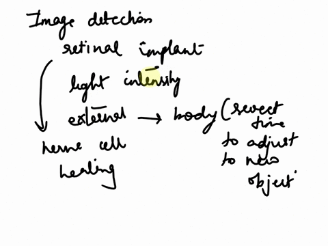 4-image-detection-by-the-retina-10-points-the-back-of-the-retina-is-covered-with-a-single-layer-of-photoreceptor-cells-this-configuration-is-like-a-camera-consisting-of-an-array-of-photodete-71683