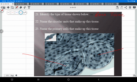 21-identify-the-type-of-tissue-shown-below_-22-name-the-circular-units-that-make-up-this-tissue-23-name-the-primary-cells-that-make-up-this-tissue-37063