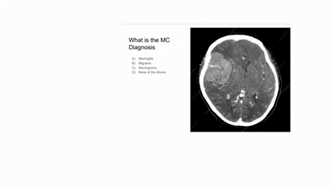 what-is-the-mc-diagnosis-a-meningitis-b-migraine-c-meningioma-d-none-of-the-above