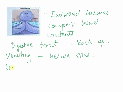 dcsn-layout-aclcrcncer-hailint-aatn-eet-33-384a-4b-mahecm-habeandf-aabbl-2-4-week-iater-he-develops-vomiting-and-abdominal-pain-mn-soft-4ss-palpable-at-the-surgica-site-an-incisional-hernia-03944