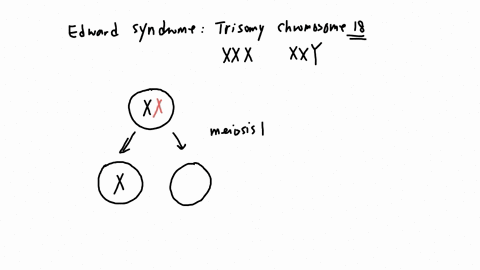 explain-the-non-disjunction-of-chromosomes-that-lead-to-edward-syndrome