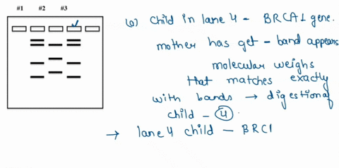 1-2-3-6-to-the-left-is-a-drawing-of-the-results-of-dna-gel-electrophoresis_-three-dna-were-analyzed-lane-2-is-dna-from-a-woman-with-the-brca-cancer-e_-causing-rflp-mutation-while-lane-3-and-55799