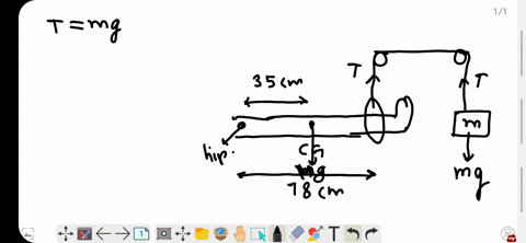 i-calculate-the-mass-m-needed-in-order-to-suspend-the-leg-shown-in-fig-9-47-assume-the-leg-with-cast-has-a-mass-of-150-kg-and-its-_cg-is-350-cm-from-the-hip-joint-the-cord-holding-the-sling-is-780-c-2