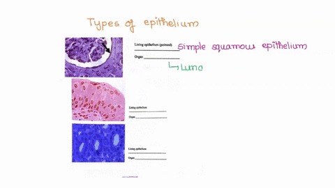 take-note-if-there-are-any-cell-surfuce-specializations-cilia-stereocilia-takc-notc-of-landmarks-stnictuncs-that-would-hclp-you-idcntify-thc-kind-of-tissuc-idenuly-lining-epithelium-pointed-47037