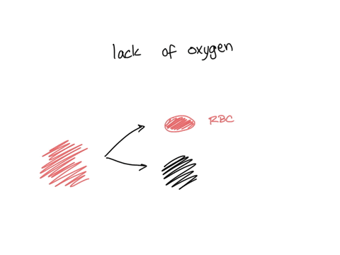 gerald-is-lightheaded-and-tired-from-a-lack-of-oxygen-in-his-tissues-what-is-most-likely-the-reason-he-feels-this-way-his-plasma-level-is-high-his-white-blood-cell-count-is-high-his-platelet-17744