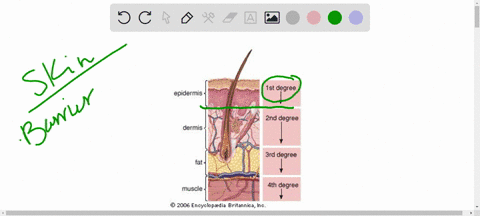 i-need-help-with-the-following-questions-1-what-are-the-effects-on-skin-functions-if-the-blood-vessels-sweat-glands-and-oil-glands-are-seriously-damaged-2-what-additional-skin-functions-are-32157
