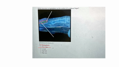 which-structure-is-highlighted-on-this-section-of-a-cadaver-finger-the-mcgraw-hill-companies-inc-epidermis-onychium-free-edge-lunule-nail-bed-16447