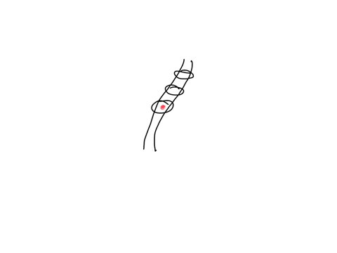 what-is-the-name-for-the-large-hole-at-the-center-of-the-vertebra-a-vertebral-foramen-b-transverse-foramen-c-intervertebral-foramen-d-sacral-foramen