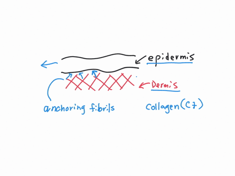 the-condition-epidermolysis-bullosa-is-characterized-by-repeated-blister-formation-resulting-from-only-minor-trauma-several-forms-of-the-disease-are-caused-by-mutations-in-genes-coding-for-keratin-pro