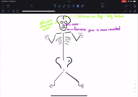 1-you-can-tell-the-age-of-a-skeleton-by-looking-ata-the-length-of-the-femur-b-the-number-of-fused-bones-c-the-shape-of-the-pelvis-d-the-color-of-the-bones2-in-general-a-female-skeleton-will-37403