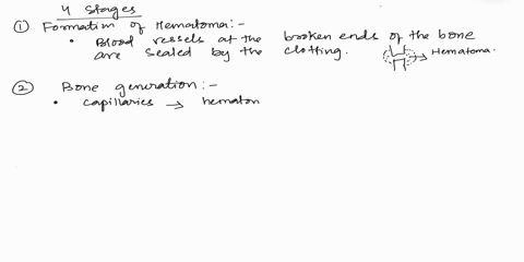 which-of-the-following-is-the-correct-order-of-events-in-bone-repair-of-a-fracture-a-hematoma-bony-callus-remodeling-fibrocartilage-callus-b-bony-callus-hematoma-fibrocartilage-callus-remode-79596