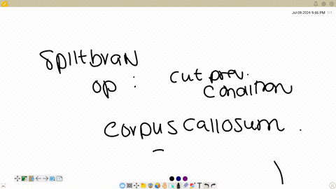 a-split-brain-operation-cuts-the-qquad-to-prevent-qquad-hippocampus-insomnia-glia-seizures-glia-insomnia-corpus-callosum-seizures