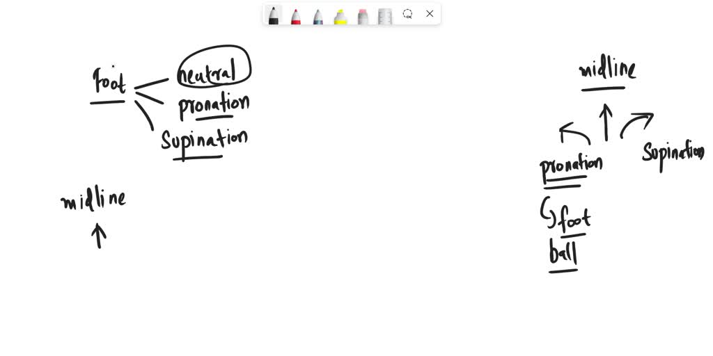 SOLVED Antipronation shoes are specialized shoes designed to prevent