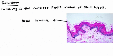 5-loose-areolar-connective-tissue-surface-of-skin-6basal-lamina-7-stratified-squamous-epithelium-19023