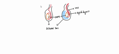 the-accumulation-of-serous-fluid-in-the-scrotal-sac-is-called-47983