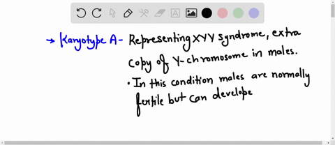 compare-and-contrast-the-karyotypes-below-and-explain-which-is-more-likely-to-result-in-severe-negative-health-consequences-x-xx-a-21-jl-1l-lxs-j-dig-ir-v-w-i-87693