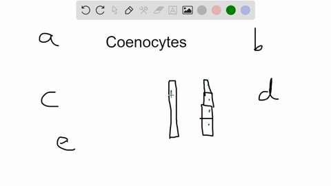 an-example-of-a-fungus-with-a-coenocytic-aseptate-mycelium-is-penicillium-saccharomyces-cerevisiae-rhizopus-stolonifer-agaricus-bisporus-none-of-these-fungi-61644