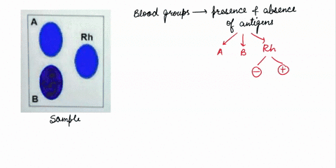 procodure-4-determine-rh-another-characteristic-of-blood-is-the-rh-factor-although-more-than-two-alleles-determine-rh-weil-use-positive-and-negative-for-simplicity-and-convenience-as-in-bloo-34087