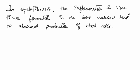 myelofibrosis-is-a-disorder-in-which-inflammation-and-scar-tissue-formation-in-the-bone-marrow-impai-73812